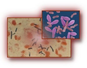 Enterotossemia da Clostridium perfringens