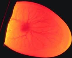 speratura